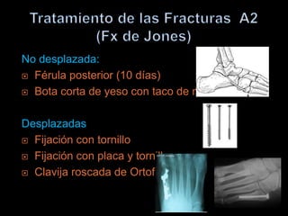 No desplazada:
 Férula posterior (10 días)

 Bota corta de yeso con taco de marcha



Desplazadas
 Fijación con tornillo

 Fijación con placa y tornillos

 Clavija roscada de Ortofix
 