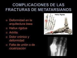    Deformidad en la
    arquitectura ósea
   Hallux rigidus
   Artritis
   Dolor crónico y
    deformidad
   Falta de unión o de
    cicatrización
 