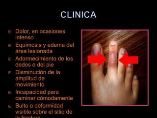    Dolor, en ocasiones
    intenso
   Equimosis y edema del
    área lesionada
   Adormecimiento de los
    dedos o del pie
   Disminución de la
    amplitud de
    movimiento
   Incapacidad para
    caminar cómodamente
   Bulto o deformidad
    visible sobre el sitio de
 