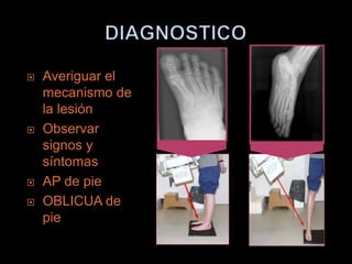    Averiguar el
    mecanismo de
    la lesión
   Observar
    signos y
    síntomas
   AP de pie
   OBLICUA de
    pie
 