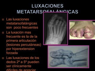    Las luxaciones
    metatarsofalángicas
    son poco frecuentes
   La luxación mas
    frecuente es la de la
    primera articulación
    (lesiones percutáneas)
    por hiperextension
    forzada
   Las luxaciones de los
    dedos 2º a 5º pueden
    ser clínicamente
 