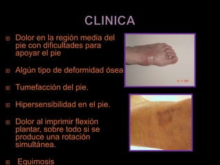    Dolor en la región media del
    pie con dificultades para
    apoyar el pie

   Algún tipo de deformidad ósea

   Tumefacción del pie.

   Hipersensibilidad en el pie.

   Dolor al imprimir flexión
    plantar, sobre todo si se
    produce una rotación
    simultánea.

   Equimosis
 