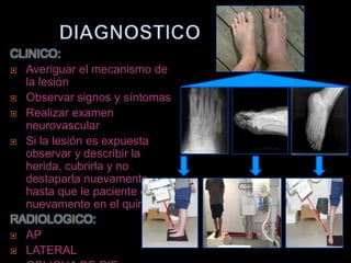 CLINICO:
 Averiguar el mecanismo de
  la lesión
 Observar signos y síntomas

 Realizar examen
  neurovascular
 Si la lesión es expuesta
  observar y describir la
  herida, cubrirla y no
  destaparla nuevamente
  hasta que le paciente este
  nuevamente en el quirófano
RADIOLOGICO:
 AP

 LATERAL
 
