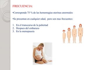 FRECUENCIA:
•Corresponde 75 % de las hemorragias uterinas anormales
•Se presentan en cualquier edad, pero son mas frecuentes:
1. En el transcurso de la pubertad
2. Despues del embarazo
3. En la menopausia
 