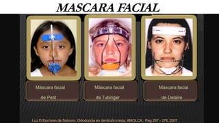 MASCARA FACIAL
Máscara facial Máscara facial Máscara facial
de Petit de Tubinger de Delaire
Luz D Escrivan de Saturno. Ortodoncia en dentición mixta. AMOLCA , Pag.267 - 276,2007.
 