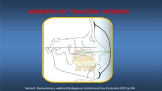 APARATOS DE TRACCIÓN ANTERIOR
Nanda,R. Biomecánicas y estética.Estrategias en ortodoncia clínica. Ed.Amolca.2007.pp.268
 