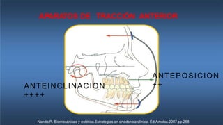 APARATOS DE TRACCIÓN ANTERIOR
Nanda,R. Biomecánicas y estética.Estrategias en ortodoncia clínica. Ed.Amolca.2007.pp.268
ANTEINCLINACION
++++
ANTEPOSICION
++
 