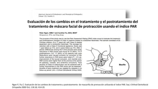 Evaluación de los cambios en el tratamiento y el postratamiento del
tratamiento de máscara facial de protracción usando el índice PAR
Ngan P, Yiu C. Evaluación de los cambios de tratamiento y postratamiento de mascarilla de protracción utilizando el índice PAR. Soy J Orthod Dentofacial
Ortopedia 2000 Oct; 118 (4): 414-20.
 