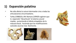 1) Expansión palatina
• No sólo afecta la sutura intermaxilar sino a todas las
articulaciones circunmaxilares.
• Turley (1988)10 y Mc Namara (1994)9 sugieren que
la expansión “desarticula” el sistema sutural
maxilar, aumentando el efecto ortopédico de la
máscara facial, haciendo que las modificaciones
sutúrales ocurran más fácilmente.
 