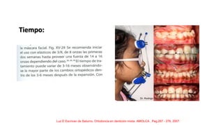 Tiempo:
Luz D Escrivan de Saturno. Ortodoncia en dentición mixta. AMOLCA , Pag.267 - 276, 2007.
 