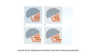 Escriban de SL .Ortodoncia en dentición mixta. Edit. Amolca Venezuela 2007.
 