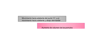 Movimiento hacia adelante del punto “A” y un
movimiento hacia adelante y abajo delmaxilar
Aumento de volumen de los pomulos
 