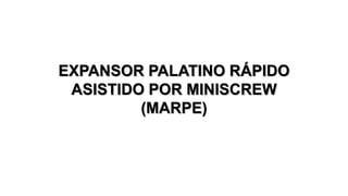 EXPANSOR PALATINO RÁPIDO
ASISTIDO POR MINISCREW
(MARPE)
 