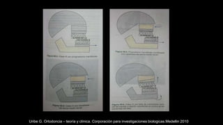 Uribe G. Ortodoncia – teoría y clínica. Corporación para investigaciones biologicas.Medellin 2010
 