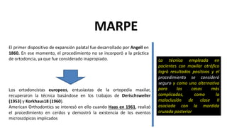 MARPE
El primer dispositivo de expansión palatal fue desarrollado por Angell en
1860. En ese momento, el procedimiento no se incorporó a la práctica
de ortodoncia, ya que fue considerado inapropiado.
Los ortodoncistas europeos, entusiastas de la ortopedia maxilar,
recuperaron la técnica basándose en los trabajos de Derischsweiler
(1953) y Korkhaus18 (1960).
American Orthodontics se interesó en ello cuando Haas en 1961, realizó
el procedimiento en cerdos y demostró la existencia de los eventos
microscópicos implicados
La técnica empleada en
pacientes con maxilar atrófico
logró resultados positivos y el
procedimiento se consideró
seguro y como una alternativa
para los casos más
complicados, como la
maloclusión de clase II
asociada con la mordida
cruzada posterior
 
