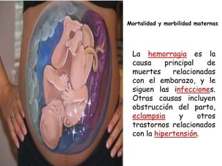 Mortalidad y morbilidad maternas




 La hemorragia es la
 causa     principal    de
 muertes     relacionadas
 con el embarazo, y le
 siguen las infecciones.
 Otras causas incluyen
 obstrucción del parto,
 eclampsia     y     otros
 trastornos relacionados
 con la hipertensión.
 