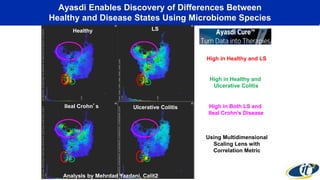 Ayasdi Enables Discovery of Differences Between 
Healthy and Disease States Using Microbiome Species 
Healthy LS 
Ileal Crohn’s Ulcerative Colitis 
High in Healthy and LS 
High in Healthy and 
Ulcerative Colitis 
High in Both LS and 
Ileal Crohn’s Disease 
Using Multidimensional 
Scaling Lens with 
Correlation Metric 
Analysis by Mehrdad Yazdani, Calit2 
 