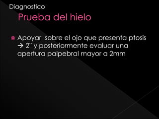 Diagnostico



Apoyar sobre el ojo que presenta ptosis
 2¨ y posteriormente evaluar una
apertura palpebral mayor a 2mm

 