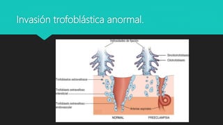 Invasión trofoblástica anormal.
 