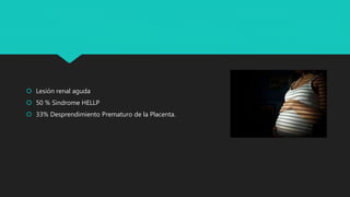  Lesión renal aguda
 50 % Sindrome HELLP
 33% Desprendimiento Prematuro de la Placenta.
 