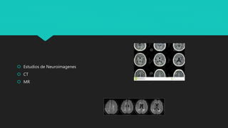  Estudios de Neuroimagenes
 CT
 MR
 