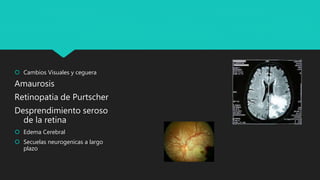  Cambios Visuales y ceguera
Amaurosis
Retinopatia de Purtscher
Desprendimiento seroso
de la retina
 Edema Cerebral
 Secuelas neurogenicas a largo
plazo
 