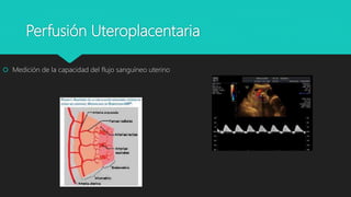 Perfusión Uteroplacentaria
 Medición de la capacidad del flujo sanguíneo uterino
 