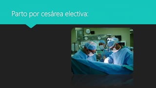 Parto por cesárea electiva:
 