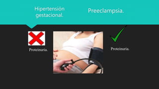 Hipertensión
gestacional.
Preeclampsia.
Proteinuria. Proteinuria.
 