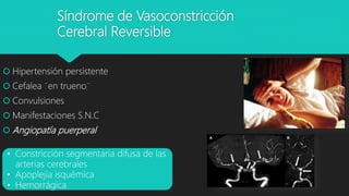 Síndrome de Vasoconstricción
Cerebral Reversible
 Hipertensión persistente
 Cefalea ¨en trueno¨
 Convulsiones
 Manifestaciones S.N.C
 Angiopatía puerperal
• Constricción segmentaria difusa de las
arterias cerebrales
• Apoplejía isquémica
• Hemorrágica
 