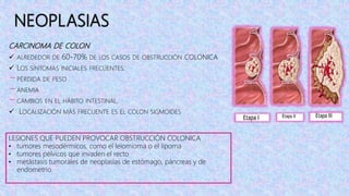 NEOPLASIAS
CARCINOMA DE COLON
 ALREDEDOR DE 60-70% DE LOS CASOS DE OBSTRUCCIÓN COLONICA
 LOS SÍNTOMAS INICIALES FRECUENTES:
−PÉRDIDA DE PESO
−ANEMIA
−CAMBIOS EN EL HÁBITO INTESTINAL.
 LOCALIZACIÓN MÁS FRECUENTE ES EL COLON SIGMOIDES
LESIONES QUE PUEDEN PROVOCAR OBSTRUCCIÓN COLONICA
• tumores mesodérmicos, como el leiomioma o el lipoma
• tumores pélvicos que invaden el recto
• metástasis tumorales de neoplasias de estómago, páncreas y de
endometrio
 