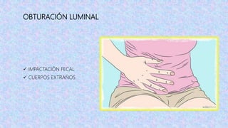 OBTURACIÓN LUMINAL
 IMPACTACIÓN FECAL
 CUERPOS EXTRAÑOS
 
