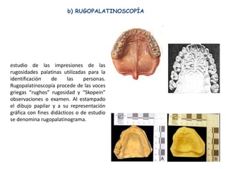 b) RUGOPALATINOSCOPÍA




estudio de las impresiones de las
rugosidades palatinas utilizadas para la
identificación    de     las    personas.
Rugopalatinoscopía procede de las voces
griegas “rughos” rugosidad y “Skopein”
observaciones o examen. Al estampado
el dibujo papilar y a su representación
gráfica con fines didácticos o de estudio
se denomina rugopalatinograma.
 