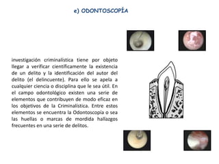e) ODONTOSCOPÍA




investigación criminalística tiene por objeto
llegar a verificar científicamente la existencia
de un delito y la identificación del autor del
delito (el delincuente). Para ello se apela a
cualquier ciencia o disciplina que le sea útil. En
el campo odontológico existen una serie de
elementos que contribuyen de modo eficaz en
los objetivos de la Criminalística. Entre estos
elementos se encuentra la Odontoscopía o sea
las huellas o marcas de mordida hallazgos
frecuentes en una serie de delitos.
 