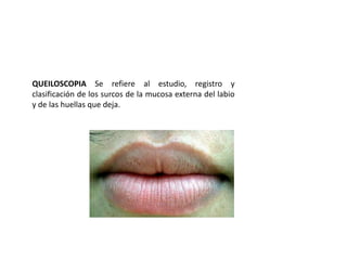 QUEILOSCOPIA Se refiere al estudio, registro y
clasificación de los surcos de la mucosa externa del labio
y de las huellas que deja.
 