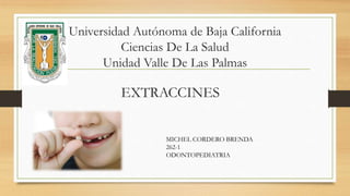 Universidad Autónoma de Baja California
Ciencias De La Salud
Unidad Valle De Las Palmas
EXTRACCINES
MICHEL CORDERO BRENDA
262-1
ODONTOPEDIATRIA
 