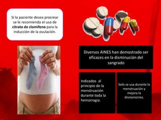 Si la paciente desea procrear
 se le recomienda el uso de
citrato de clomifeno para la
 inducción de la ovulación.




                                 Diversos AINES han demostrado ser
                                    eficaces en la disminución del
                                              sangrado



                                Indicados al
                                principio de la   Solo se usa durante la
                                                     menstruación y
                                menstruación
                                                        mejora la
                                durante toda la       dismenorrea.
                                hemorragia.
 