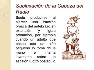 Subluxación de la Cabeza del
Radio
Suele producirse al
ejercer una tracción
brusca del antebrazo en
extensión y ligera
pronación, por ejemplo
cuando un adulto que
pasea con un niño
pequeño lo toma de la
mano e intenta
levantarlo sobre un
escalón u otro obstáculo
 