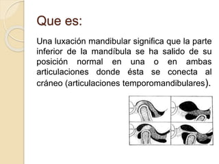 Que es:
Una luxación mandibular significa que la parte
inferior de la mandíbula se ha salido de su
posición normal en una o en ambas
articulaciones donde ésta se conecta al
cráneo (articulaciones temporomandibulares).
 