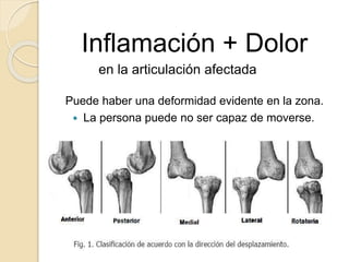 Inflamación + Dolor
en la articulación afectada .
Puede haber una deformidad evidente en la zona.
 La persona puede no ser capaz de moverse.
 