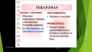UNIVERSIDA
D CENTRAL
DEL ESTE
Tumores Faríngeos 48
 