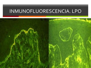 Técnicas histopatologicas e inmunohistoquimicas | PPTX