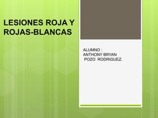 LESIONES ROJA Y
ROJAS-BLANCAS
ALUMNO :
ANTHONY BRYAN
POZO RODRIGUEZ.
 