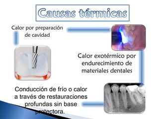 Calor por preparación de cavidad Calor exotérmico por endurecimiento de materiales dentales Conducción de frío o calor a través de restauraciones profundas sin base protectora.  