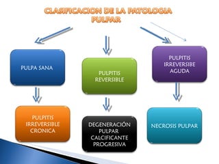 PULPA SANA  PULPITIS IRREVERSIBLE CRONICA PULPITIS REVERSIBLE PULPITIS IRREVERSIBE AGUDA NECROSIS PULPAR DEGENERACIÓN PULPAR  CALCIFICANTE PROGRESIVA 