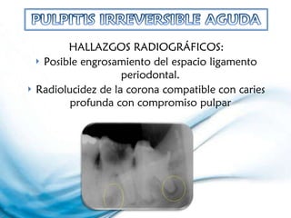 HALLAZGOS RADIOGRÁFICOS: Posible engrosamiento del espacio ligamento periodontal. Radiolucidez de la corona compatible con caries profunda con compromiso pulpar 