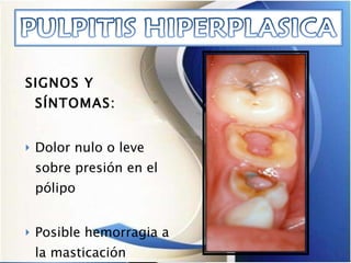SIGNOS Y SÍNTOMAS: Dolor nulo o leve sobre presión en el pólipo Posible hemorragia a la masticación 
