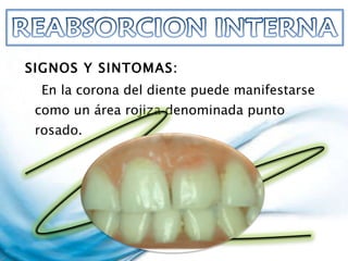 SIGNOS Y SINTOMAS: En la corona del diente puede manifestarse como un área rojiza denominada punto rosado. 