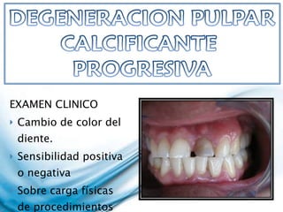 EXAMEN CLINICO Cambio de color del diente. Sensibilidad positiva o negativa  Sobre carga físicas de procedimientos restaurativos 