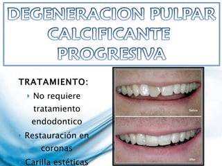 TRATAMIENTO: No requiere tratamiento endodontico Restauración en coronas Carilla estéticas 